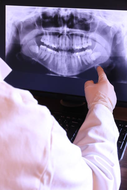 Best Emergency Dentist for Lost Fillings or Crowns in Eastman, GA
